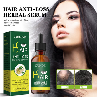 OUHOE 密发精油 头发柔顺护理修护发根浓密防掉固发强韧秀发精华