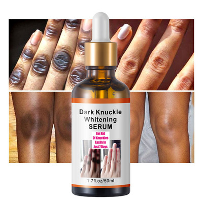 跨境手部手指关节亮肤提亮精华液 dark knuckles whitening serum