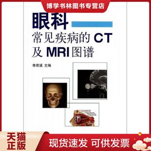 北京大学医学出版 正版 李若溪主编 CT及MRI图谱 社有限公司 现货9787565908392眼科常见疾病