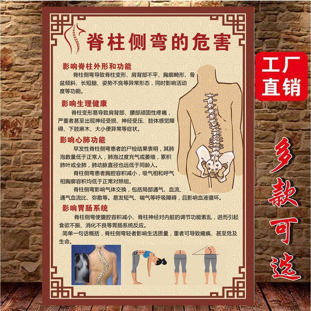 成人儿童脊柱侧弯六步筛查脊椎养护海报广告海绵文胸的危害设计KT,家居饰品,现代装饰画,淘宝优惠券,粉丝福利购,淘宝优惠卷