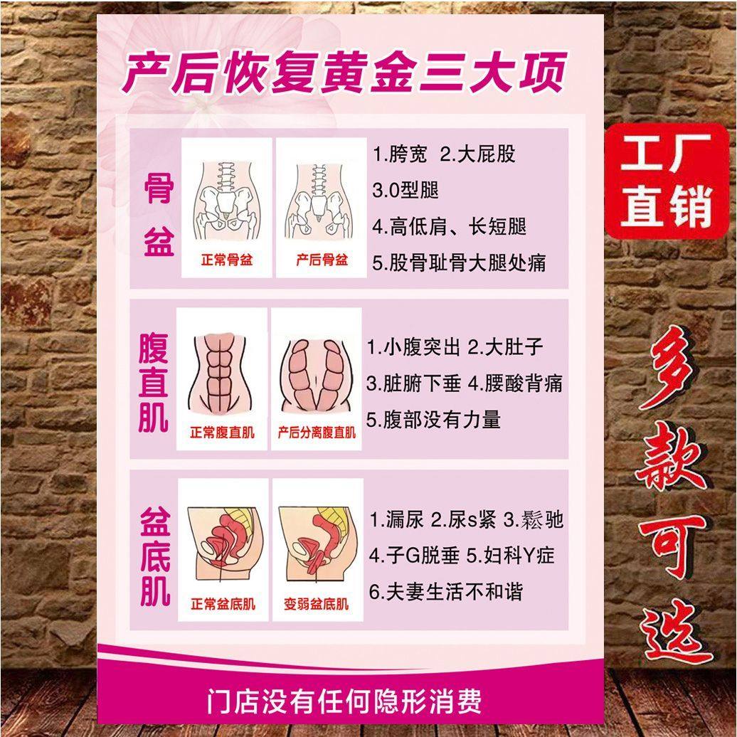 产后康复海报美容恢复宣传满月发汗挂图骨盆修复盆底肌催乳KT展板,家居饰品,现代装饰画,淘宝优惠券,粉丝福利购,淘宝优惠卷