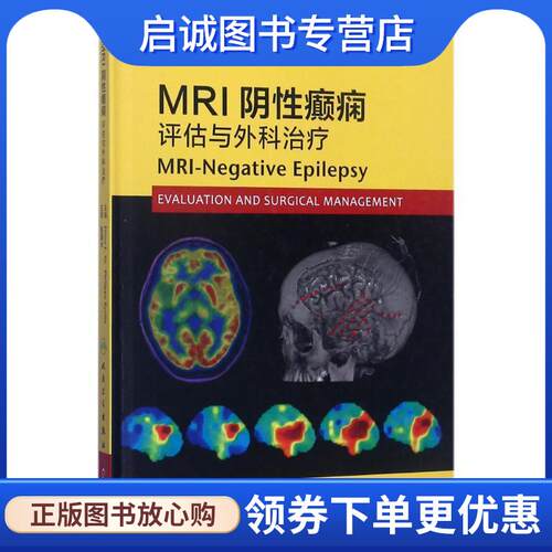 正版现货直发MRI阴性癫痫评估与外科治疗 Elson L.So,Philippe Ryvlin 编,赵国光 译 9787117247153 人民卫生出版社
