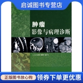 人民卫生出版 等 社 肿瘤影像与病理诊断9787117120890孔祥泉 正版