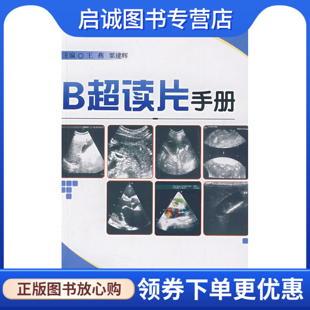 正版现货直发B超读片手册 王燕,栗建辉　主 军事医科出版社 9787801219459