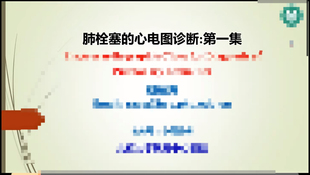 2025肺栓塞心电图判断