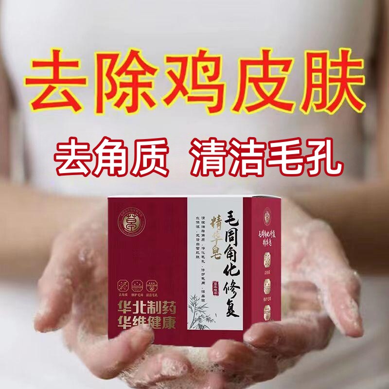 【华北制药】去鸡皮疙瘩香皂鸡皮肤鱼鳞皮肤腿部手臂毛周角化