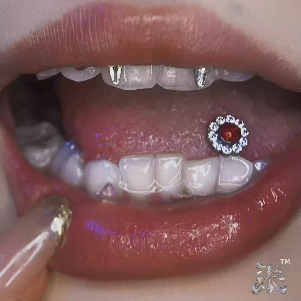 锆石太阳花1.2牙埋钉舌钉钛合金