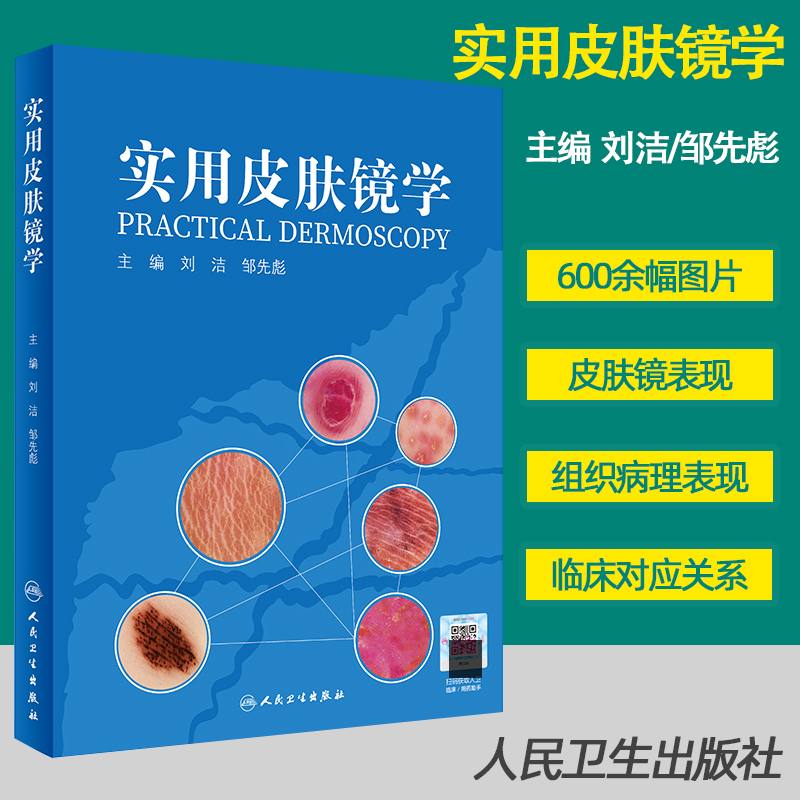 实用皮肤镜学刘洁邹先彪主编皮肤病学与性病学内容涵盖了皮肤镜的历史皮肤肿瘤诊断方法 9787117307871人民卫生出版社