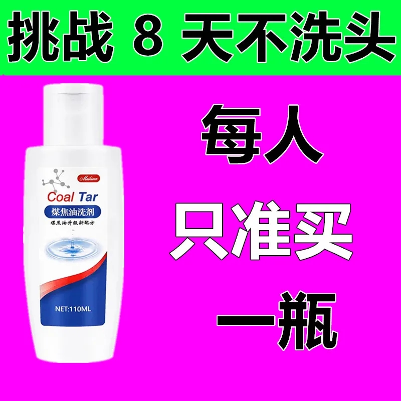 正品屑康王去头屑止痒洗发水大块头皮屑脂溢性毛囊除螨控油洗发露