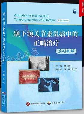颞下颌关节紊乱病中的正畸治疗病例精解 焦凯主编 颞下颌关节正畸病案分析TMDs患者多元化分级诊疗口腔正畸医学书 世界图书出版