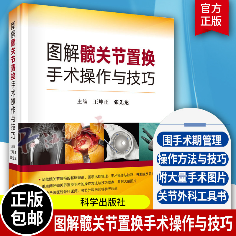 图解髋关节置换手术操作与技巧 王坤正 张先龙著 髋关节置换基础理论书 临床医学微创技术书籍 科学出版社9787030656667