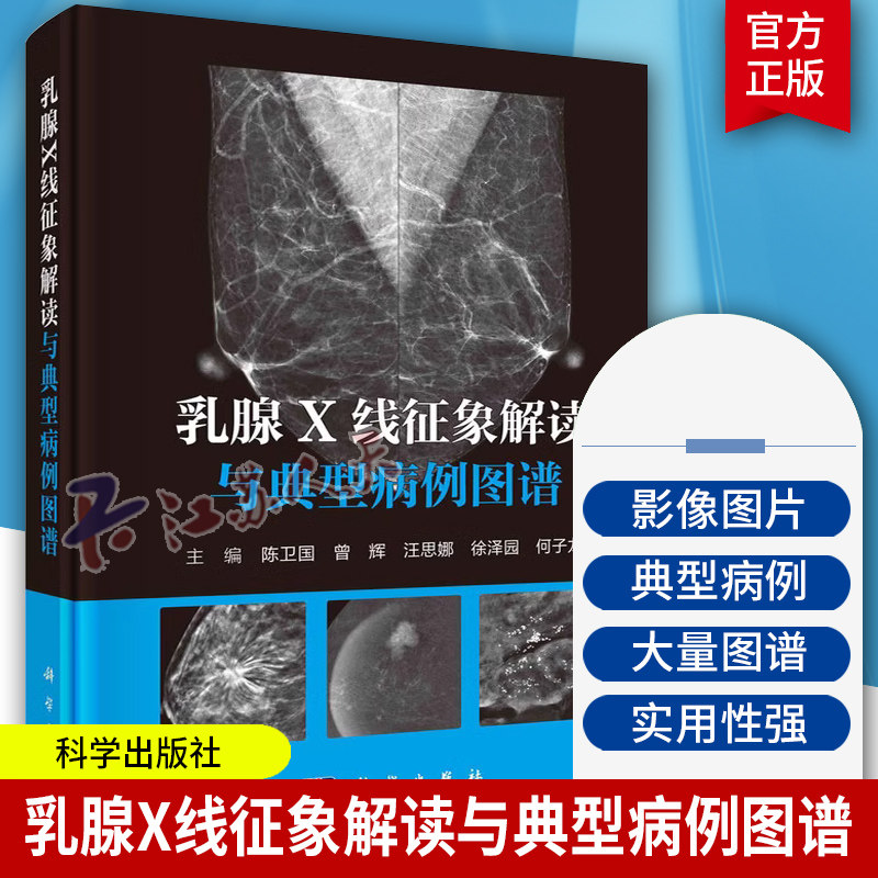 乳腺X线征象解读与典型病例图谱陈卫国 等编190多例典型病例图解形式阐述病变的诊断与BI-RADS分类依据科学出版社
