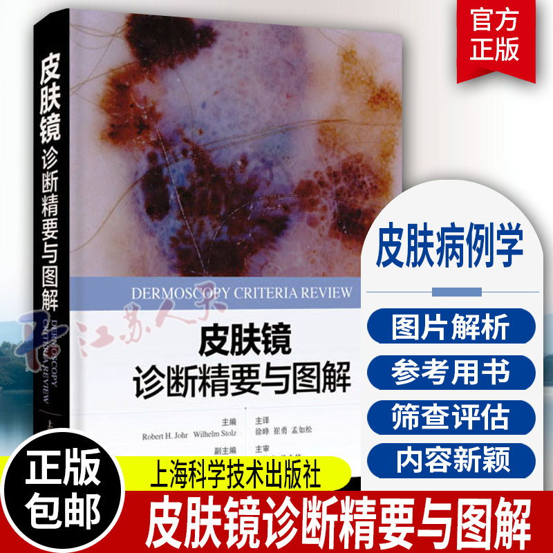皮肤镜诊断精要与图解 皮肤科医学书皮肤镜诊断图谱皮肤镜标准综述皮肤病理学医学书籍 上海科学技术出版社 9787547860823 书籍