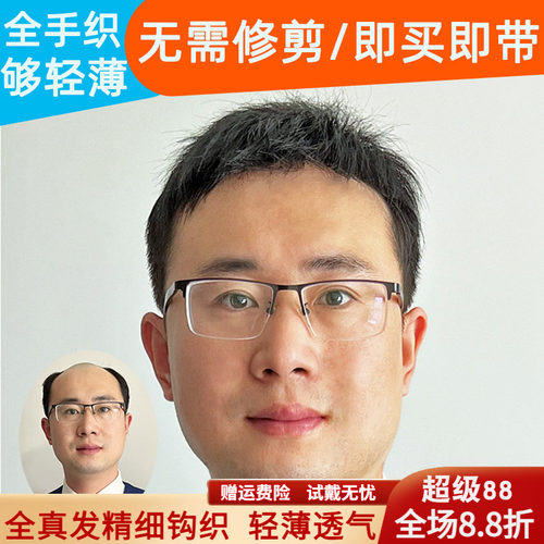 米尔真人发丝头顶补发片够轻薄