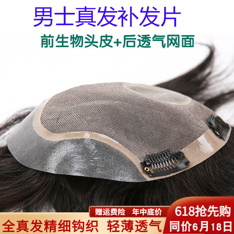 假发男头顶补发男真发短发帅气织发补发片男士秃顶前额发际线隐形