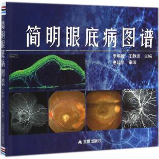 【正版】简明眼底病图谱 李明翰、王静波