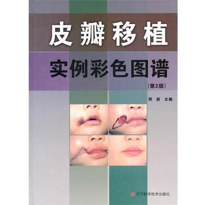 【正版】皮瓣移植实例彩色图谱(第2版)(精)978753816817 邢新