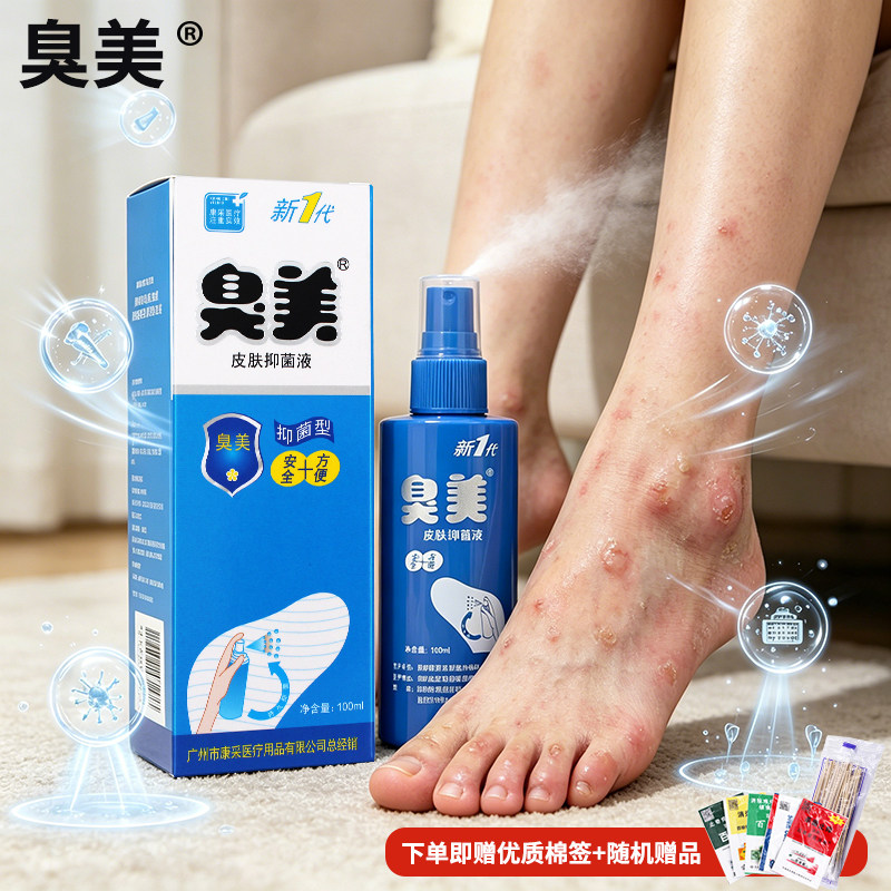 臭美官方气喷雾三合一皮肤抑菌液香港喷王泡脚粉广州康采专用脚丫