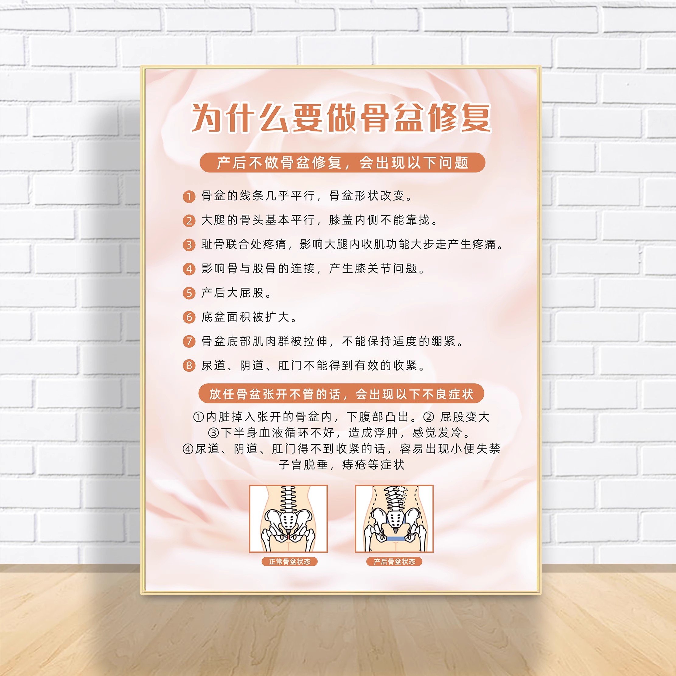 为什么要做骨盆修复产后康复恢复宣传海报月子中心挂图广告墙贴画