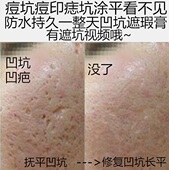 遮痘坑痘印填凹洞遮瑕膏笔痘痘凹疤痕遮盖毛孔贴男女脸部持久神器