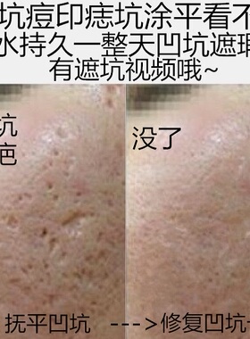 遮痘坑痘印填凹洞遮瑕膏笔痘痘凹疤痕遮盖毛孔贴男女脸部持久神器