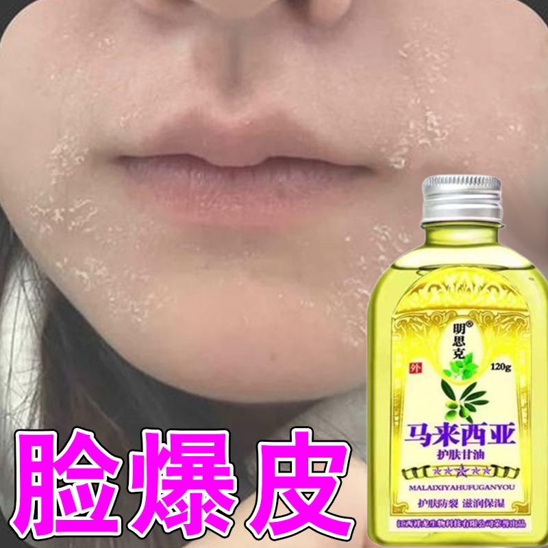 嘴周掉屑脸部干燥起皮掉皮掉皮脸爆皮起皮皮肤粗糙换季干燥季节性