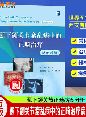颞下颌关节紊乱病中的正畸治疗病例精解 焦凯主编 颞下颌关节正畸病案分析TMDs患者多元化分级诊疗口腔正畸医学书世界图书出版公