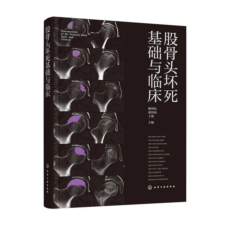股骨头坏死基础与临床 谢利民 张智海 于潼 股骨头坏死发病生理病理过程诊断依据影像学检查治疗方案生活调摄功能锻炼书籍