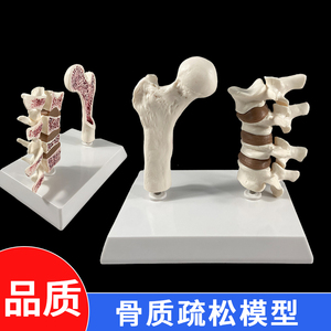 股骨头骨质疏松模型脊柱病变股骨展示骨骼人体椎间盘切面脊椎变化