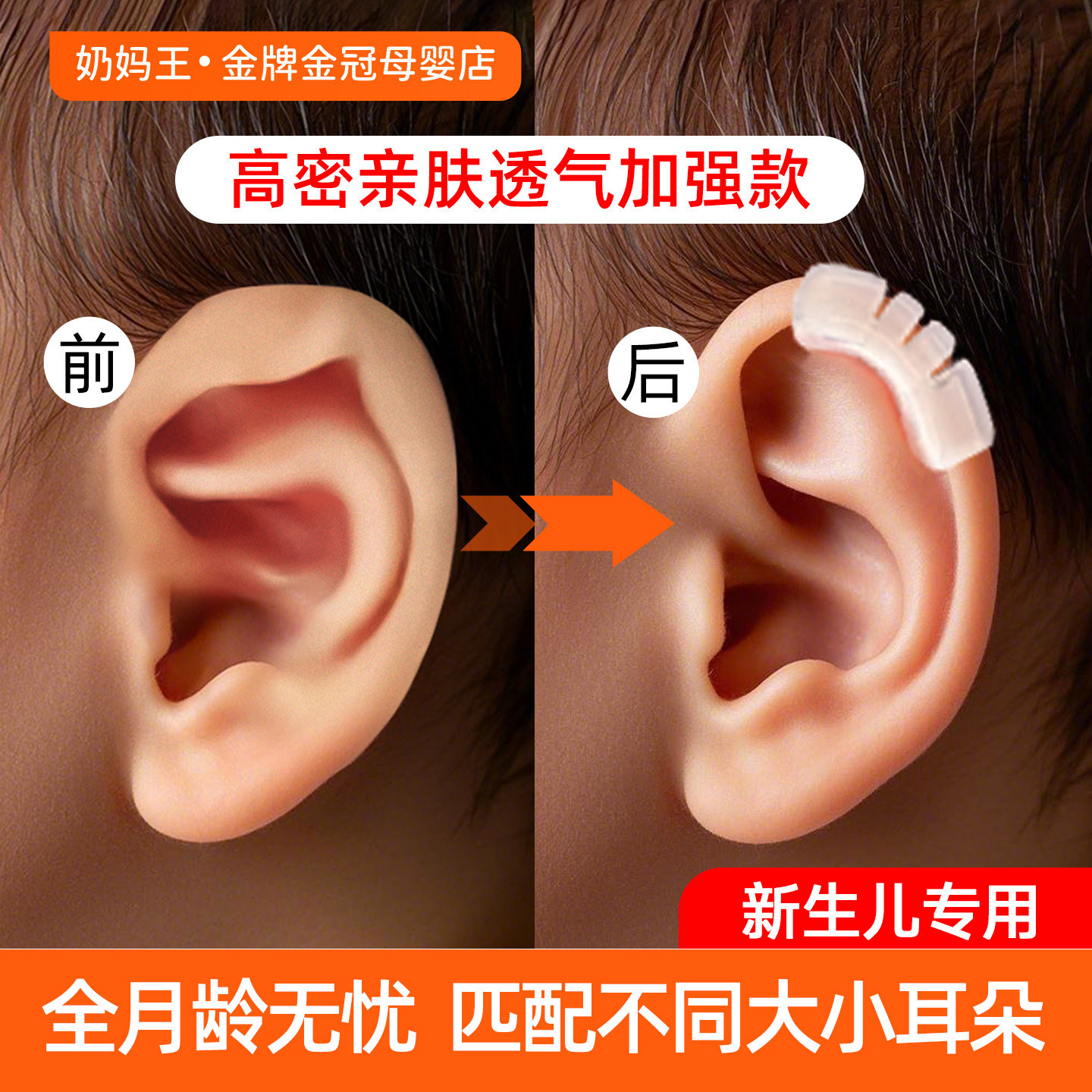 耳朵矫正器婴儿耳廓矫形器新生儿垂耳招风耳定型支撑神器纠正贴