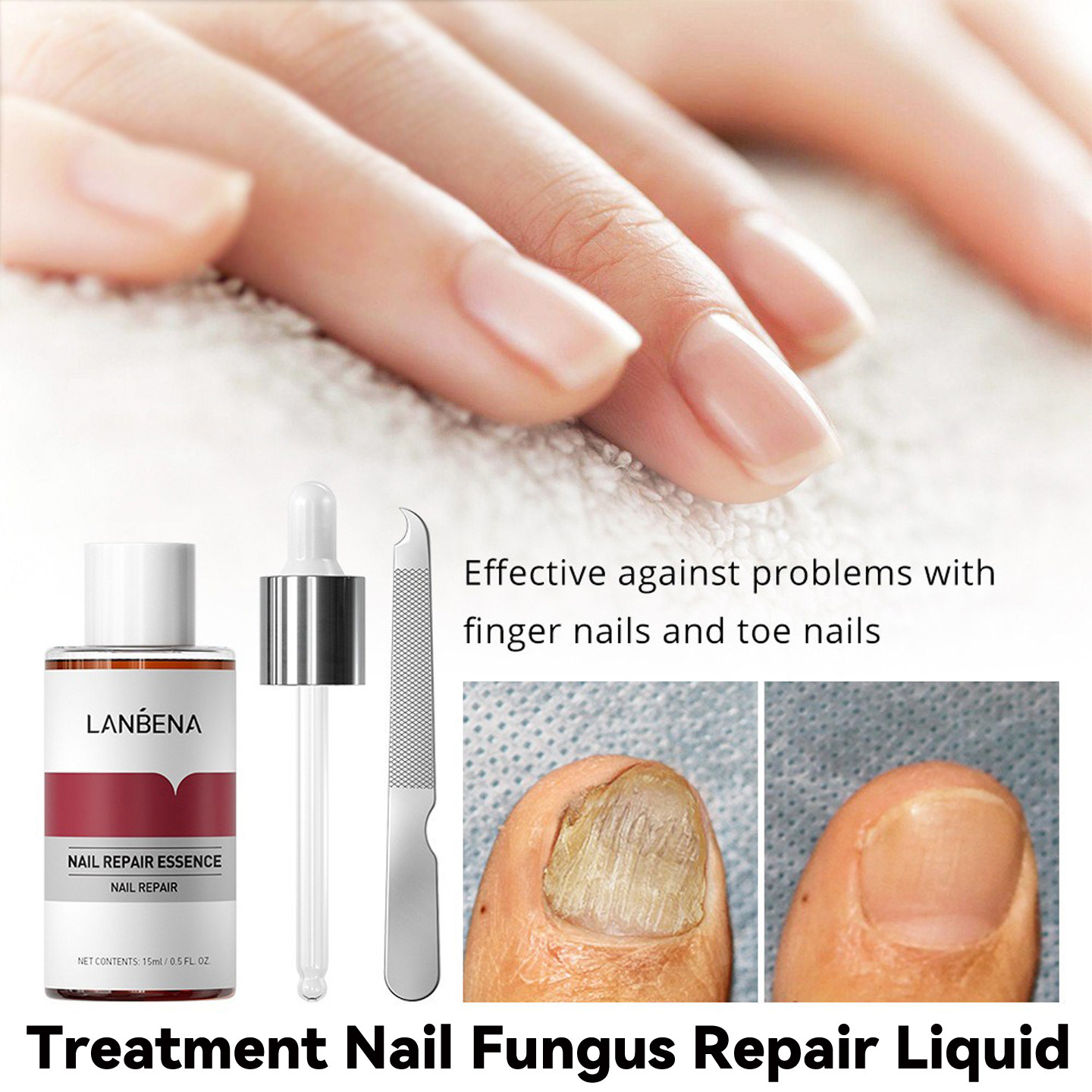 LANBENA Nail repair liquid Treating nail fungus指甲修复液