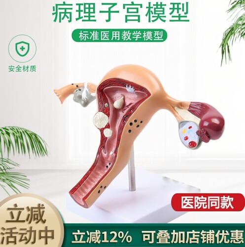 妇产高级仿真病态包邮子宫模型