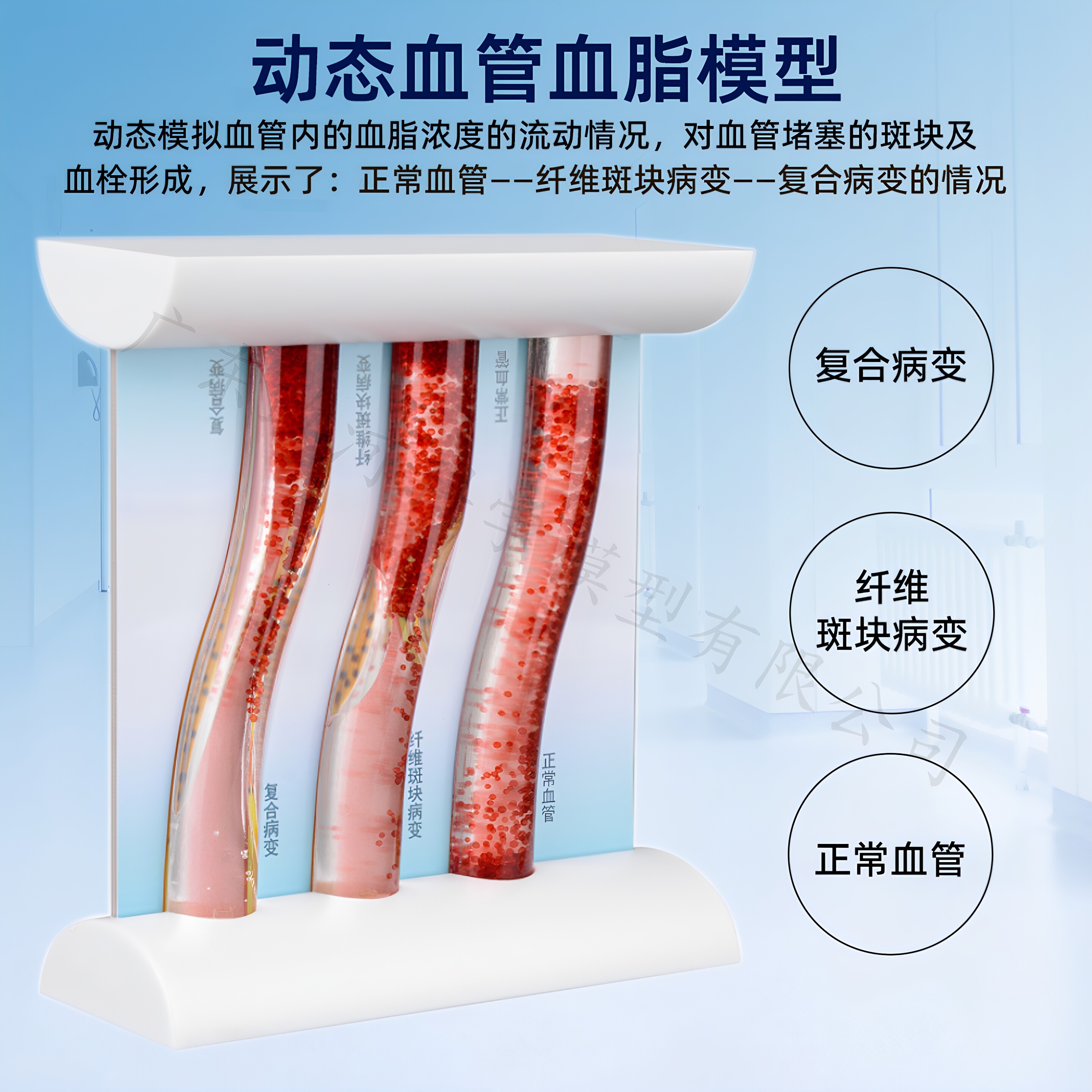 血栓模型人体血管模型动脉静脉循环系统教具医用血栓教学医患模型