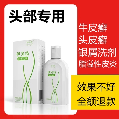 脂溢性皮炎银屑病牛皮癣洗发水