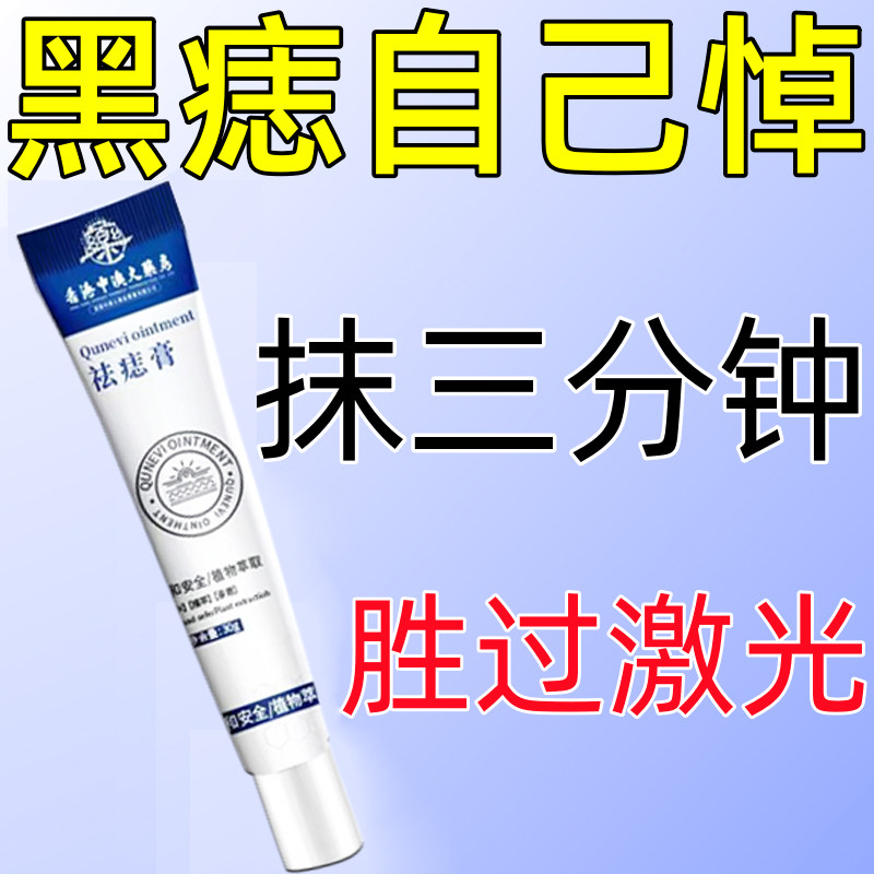 去痣膏脸部黑痣肉痣痦子无痕祛