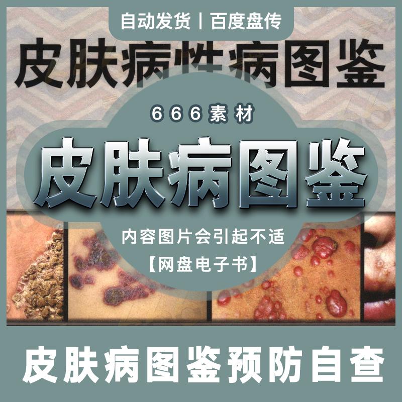 中国皮肤病性病临床表现诊断要点病理机制治疗方案图鉴网盘素材