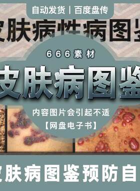 中国皮肤病性病临床表现诊断要点病理机制治疗方案图鉴网盘素材