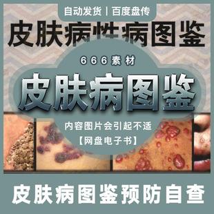 中国皮肤病性病临床表现诊断要点病理机制治疗方案图鉴网盘素材