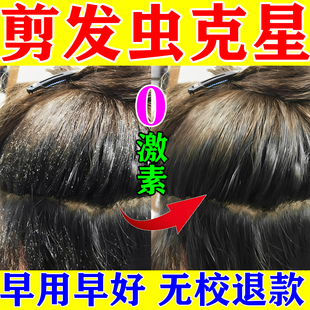 去剪发虫洗发水成人儿童除头螨卷发虫吃发虫专业祛头屑止痒喷雾剂