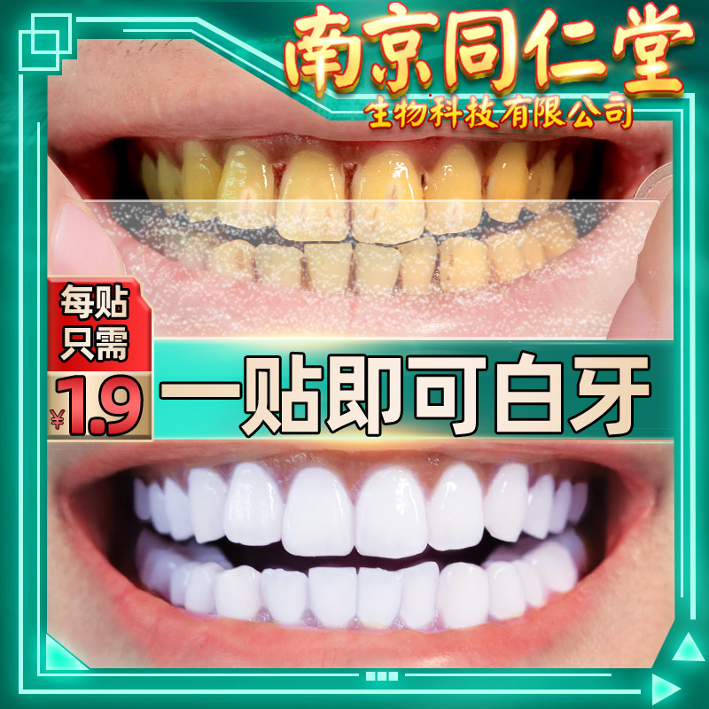 牙贴面亮白美白牙齿变白贴美牙贴去黄贴片白牙白神器洁白速效炫白