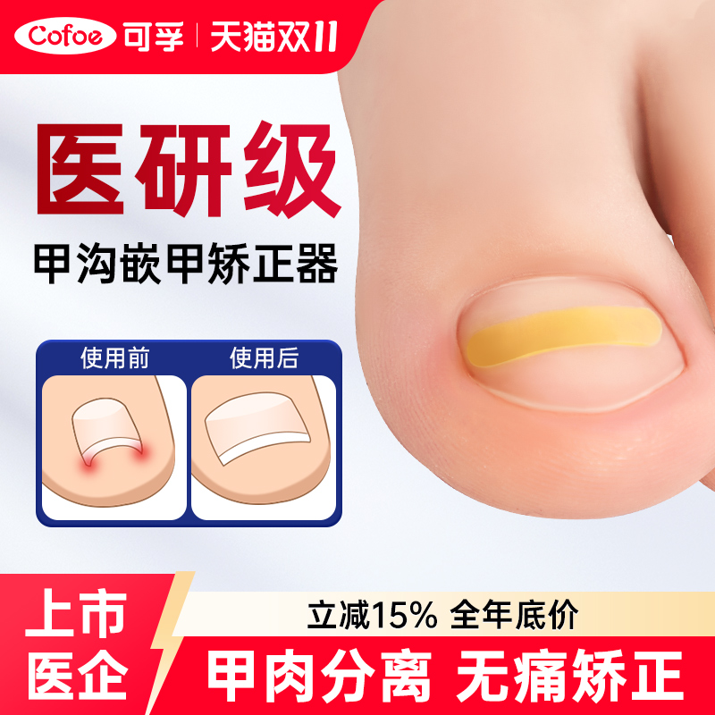 可孚嵌甲甲沟炎矫正器专用指甲贴片儿童脚趾甲正甲贴脚趾辅助器