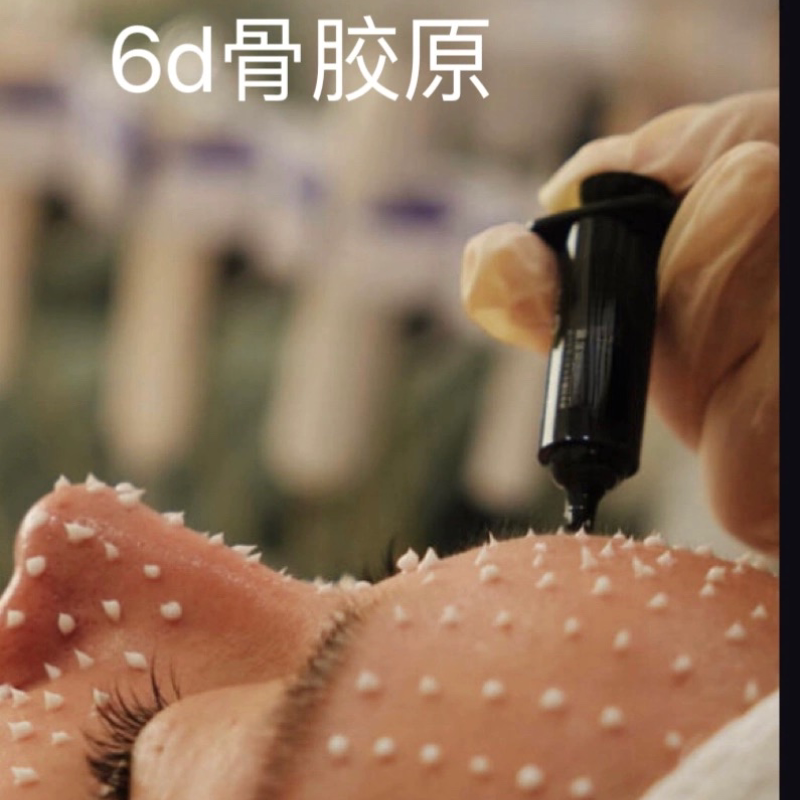 日本6d纳米胶原海绵骨针院线粉刺闭口痘痘送操作视频