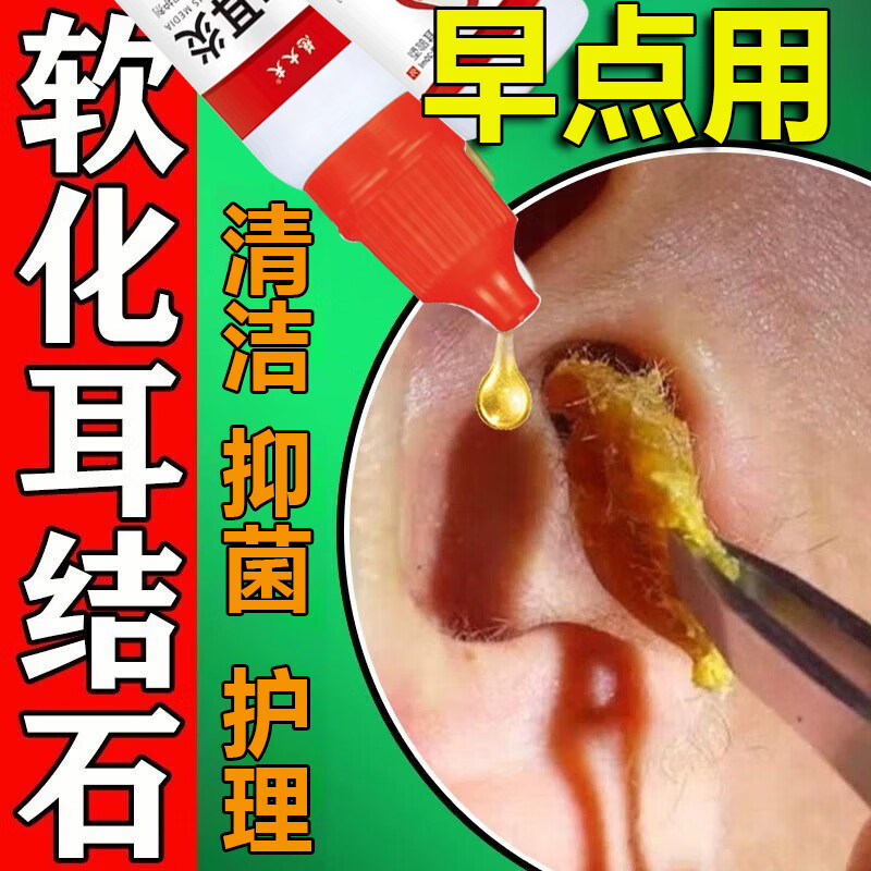 碳酸氢钠抑菌滴耳液液耳屎软化婴儿童耵聍水液剂耳垢宝宝掏耳神器