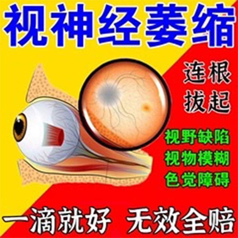 金珍滴眼液仁目滴眼液飞蚊症缓解眼睛疲劳干眼症视物模糊医用官方