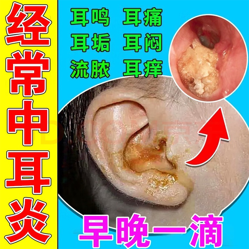 水杨酸滴耳液健邦客2%水