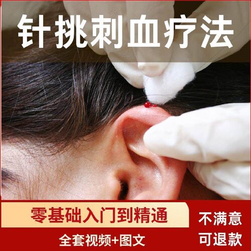针挑刺血疗法视频教程自学入门