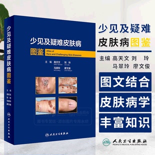 高天文等编 人民卫生出版 西京皮肤医院经病理诊断 不典型疾病 社9787117357272 少见疾病及临床错诊获修正 少见及疑难皮肤病图鉴