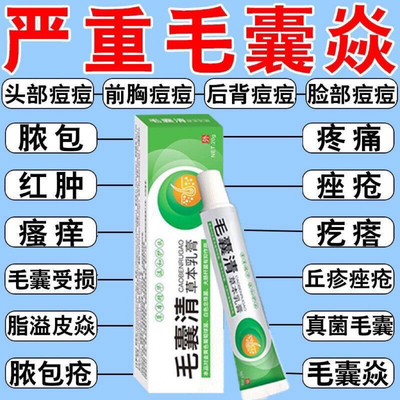 重度毛囊焱头上疙瘩头部毛囊炎