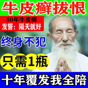 牛皮藓银屑病癣股癣手足头皮癣疹湿止痒去皮肤根专用疗治特效药膏