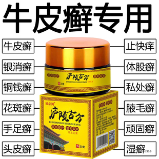 牛皮藓鲜银屑病湿皮肤专治疗头皮手足脚体股藓廯外用特效癣药膏